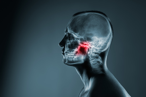 TMJ and Jaw Pain – Causes and Treatments